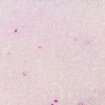 Finkornet Silicia Katteperler - 15L (14-560711)